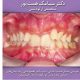 درمان ارتودنسی توسط دکتر سیامک همت پور