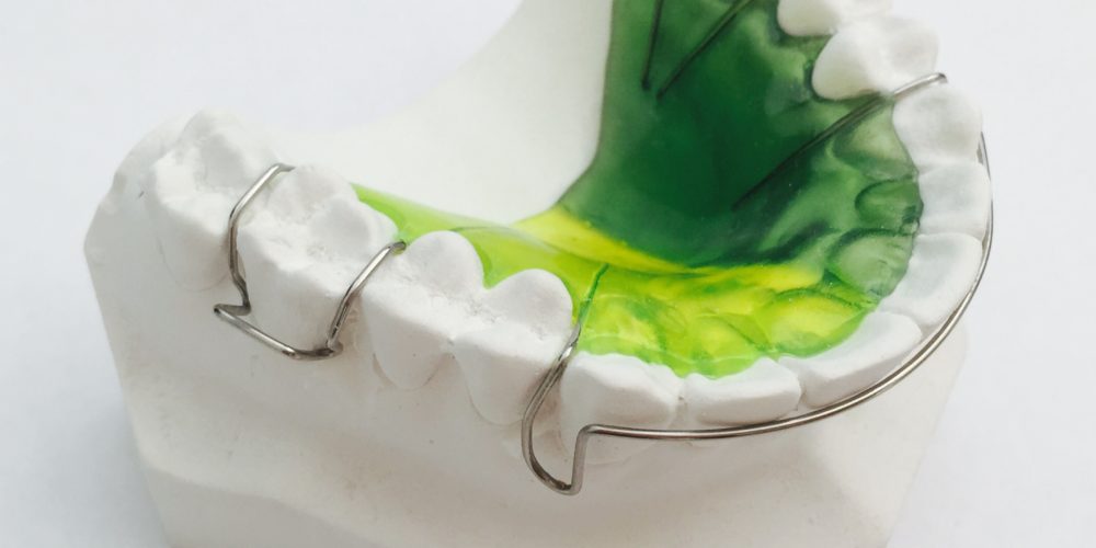مراحل ارتودنسی متحرک