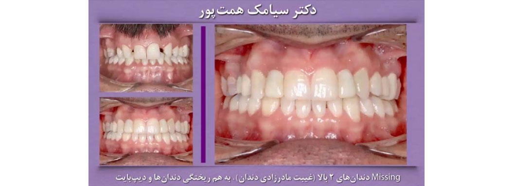 درمان ارتودنسی توسط دکتر سیامک همت پور